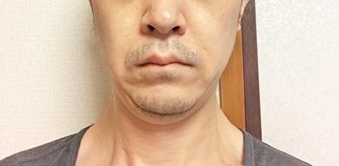 2020/01/23の顔下半分